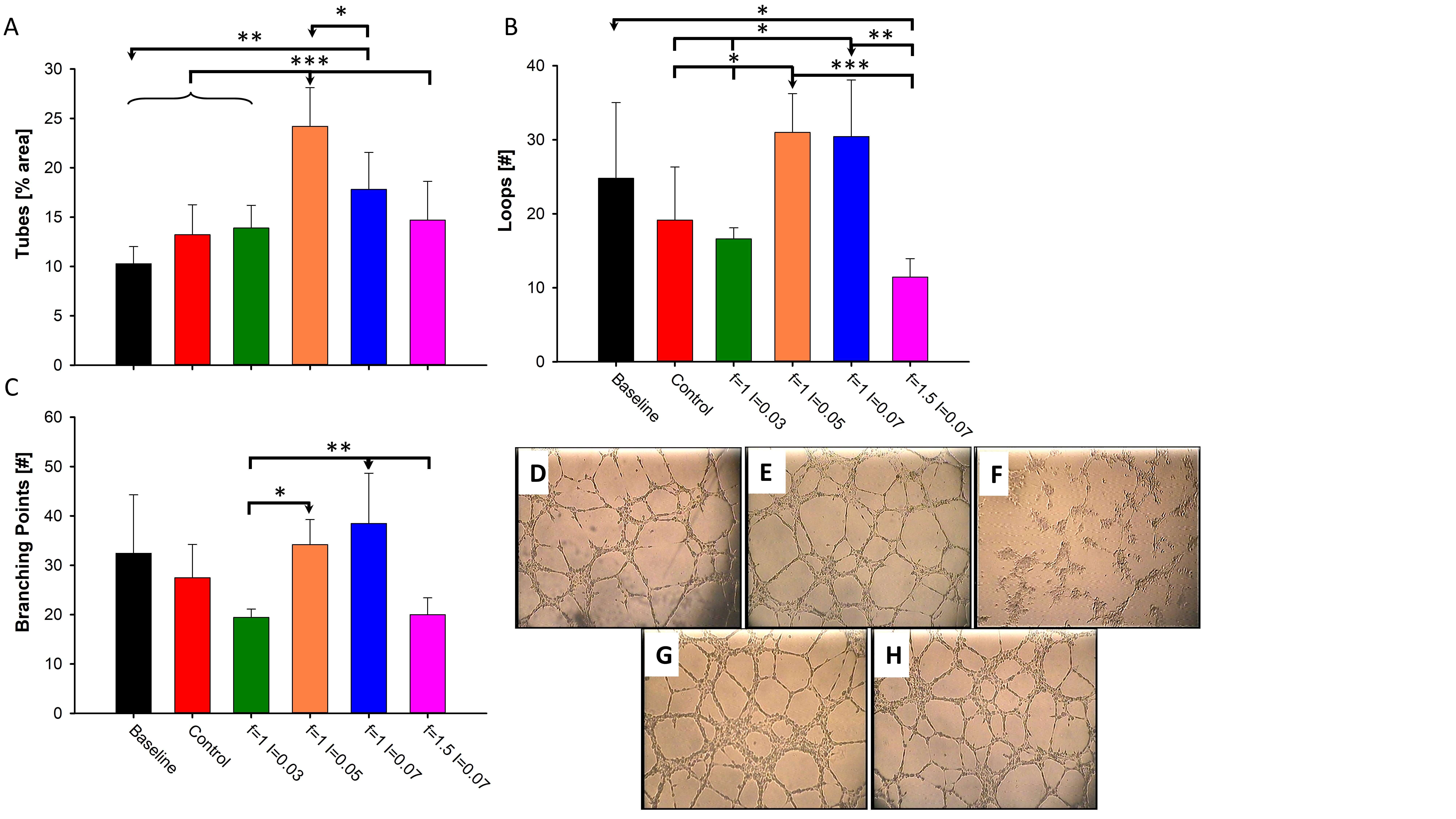 Figure 1: HUVEC tube formation assay. A. % Area occupied by tubes, B. Number of loops C. Number of branching points. For each profile a designated column composed of 5 independent experiments (n=5). Baseline - before treatment and Control - without treatment. D-H representetive pictures D. HUVEC before the TUS. E. Without treatment. F. f=1 MHz I=0.03 W/cm2. G. f=1 MHz I=0.07 W/cm2. H. f=1 MHz I=0.05 w/cm2 (x40 magnification). * P<0.05, **P<0.01 and *** P<0.001 vs. the designated group (marked by arrow head).